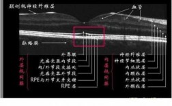 眼科视网膜复位科技知识（眼科视网膜复位科技知识点总结）