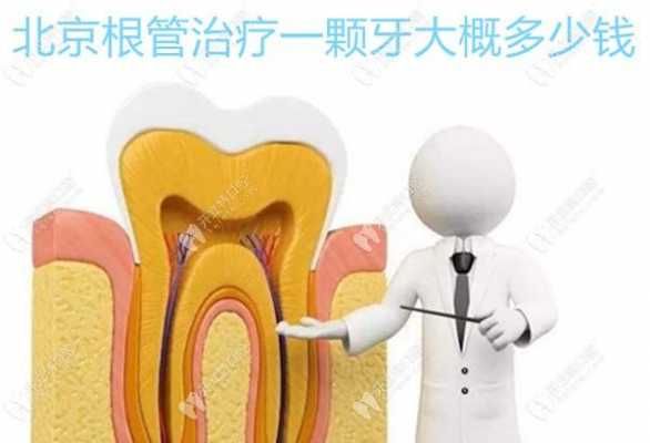 根管牙修复科技知识培训（根管修复要多少钱）-图3