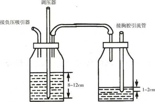 负压抽吸原理科技知识（负压抽吸原理科技知识总结）-图2