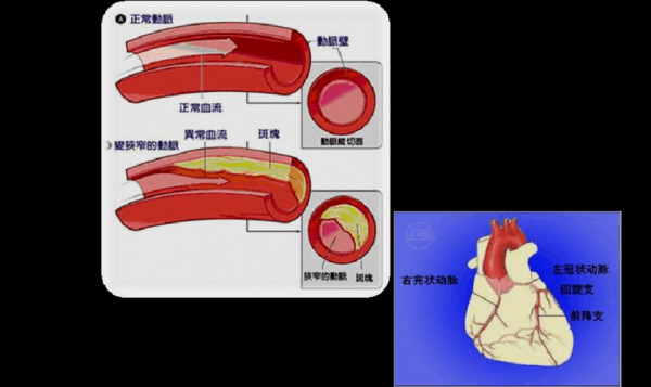 心脏内科科技知识竞赛（心脏内科知识点）-图3