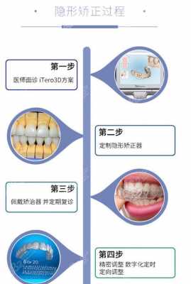 矫正牙齿科技知识大全（牙齿矫正专业知识）-图3