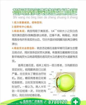 眼科视网膜复位科技知识（眼科视网膜复位科技知识点总结）-图3