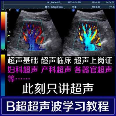 怎么能学好产科超声科技知识（产科超声视频技巧教程）-图1