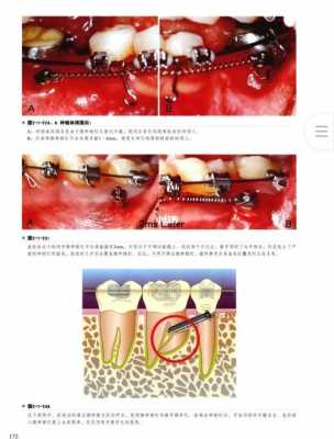 矫正牙齿科技知识（矫正牙齿科技知识培训）-图1