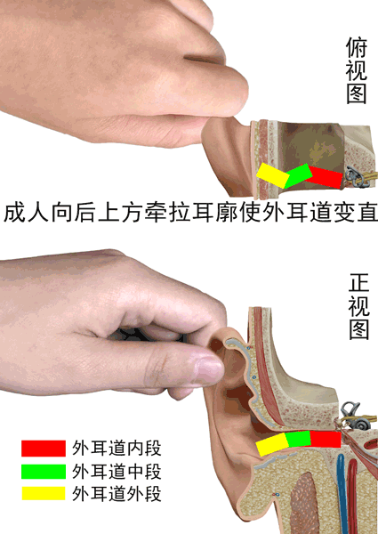 关于耳朵修复的科技知识（耳廓修复）-图1